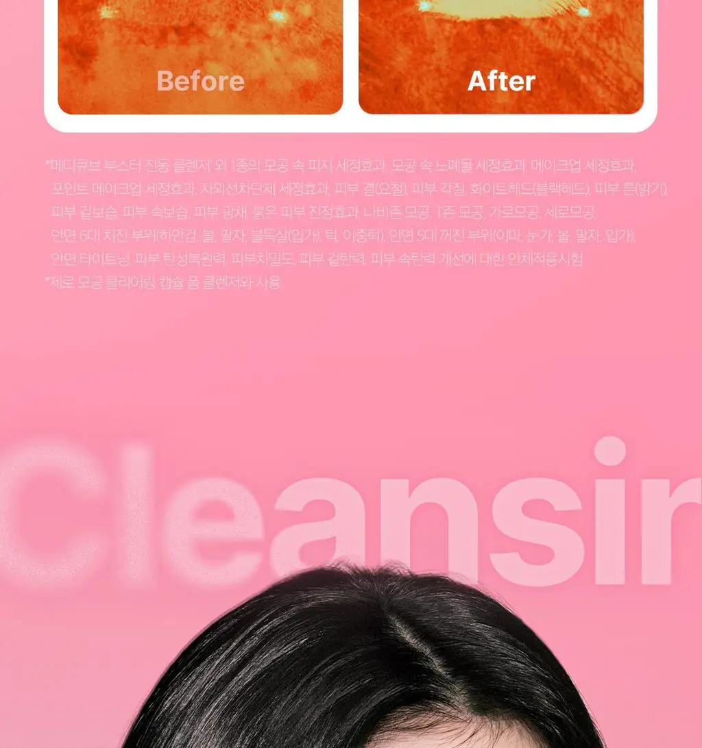 [3D진동클렌징/모공케어] 메디큐브 에이지알 부스터 진동 클렌저 헤드 (베이지/핑크) 상세페이지 17